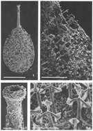 Image of Nanosylvanella palmulina Patterson 1990