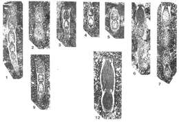 Image of Vervilleina bradyi (Spandel 1901)