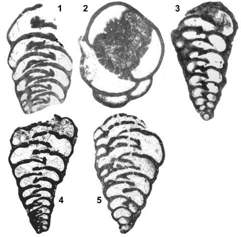 Image of Praechrysalidina infracretacea Luperto Sinni 1979