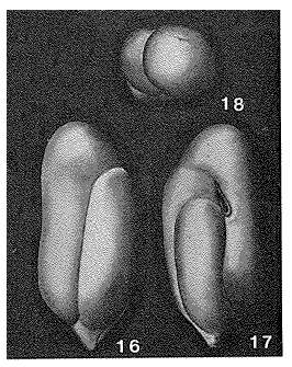 Image of Eggerina cylindrica Toulmin 1941