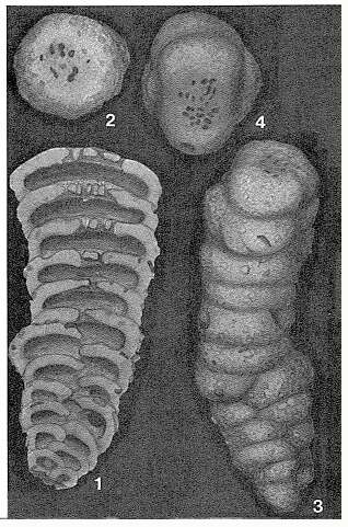 Image of Cribrogoesella robusta (Brady 1881)