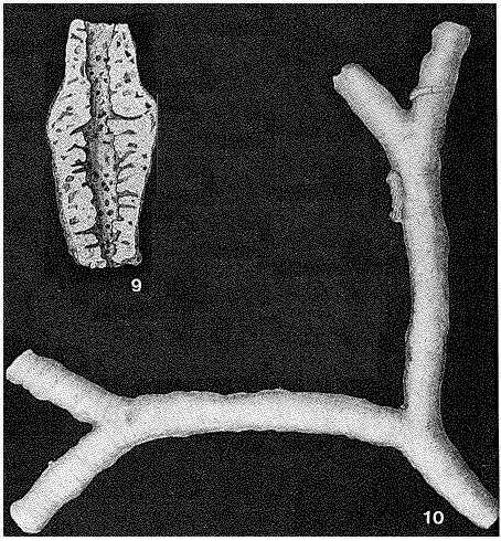 Image of Schizammina labyrinthica Heron-Allen & Earland 1929