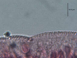 صورة Austrodiplostomum ostrowskiae Dronen 2009