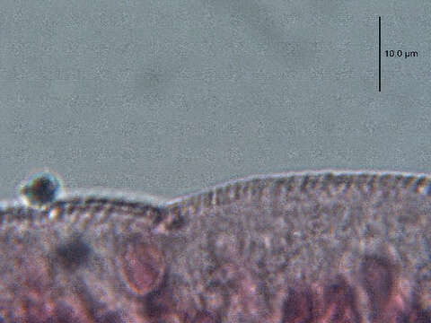 صورة Austrodiplostomum ostrowskiae Dronen 2009