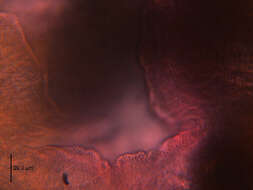 صورة Austrodiplostomum ostrowskiae Dronen 2009