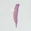 صورة Austrodiplostomum