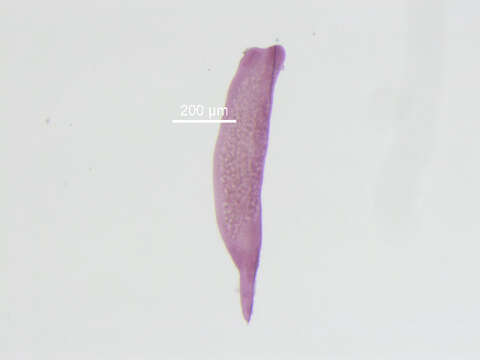 Image of Austrodiplostomum