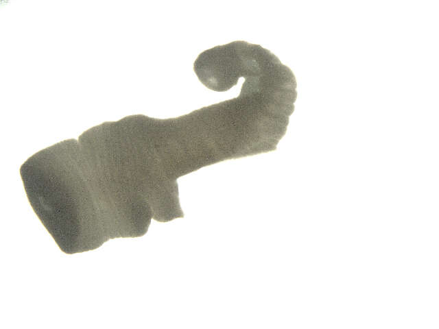 Image of Echinostomatoidea