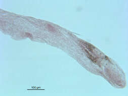 Image of <i>Neodiplostomum americanum</i>