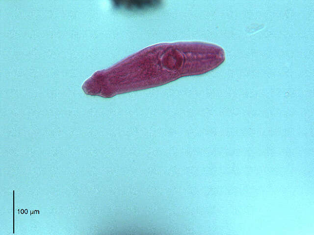 Image of flukes