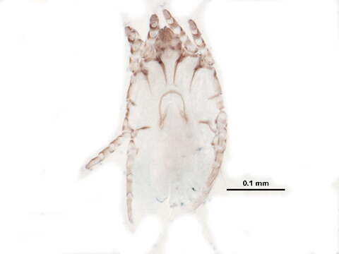 Image of scab mites