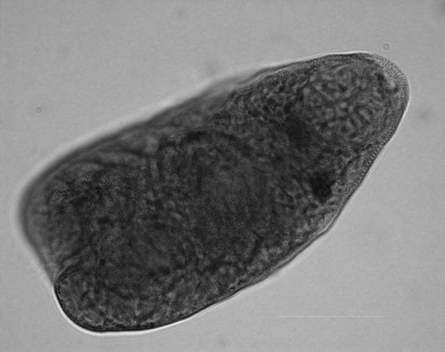 Image de Apophallus microsoma Ferguson, Locke, Font, Steinauer, Marcogliese & Coj