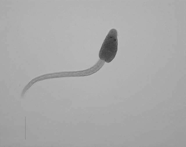 Image de Apophallus microsoma Ferguson, Locke, Font, Steinauer, Marcogliese & Coj