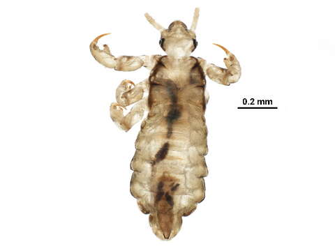 Image of head louse