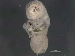 Image of penis worms