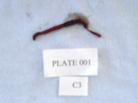 Image of segmented worms