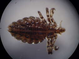 Image of sucking louse