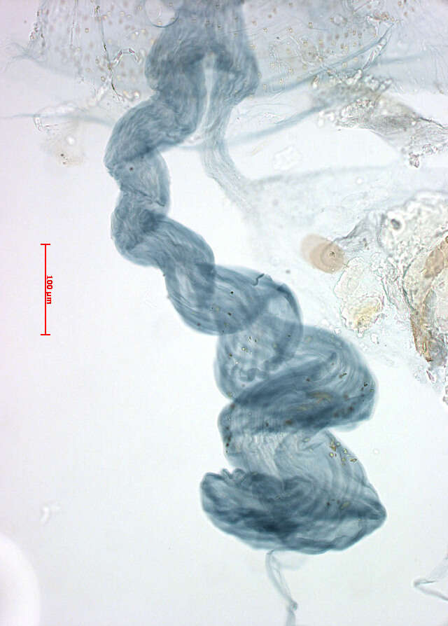 Image of Stigmella hybnerella (Hübner 1796) Fletcher et al. 1945