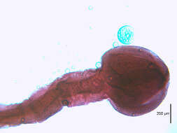 Image of Asian fish tapeworm
