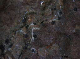 Image of sac fungi