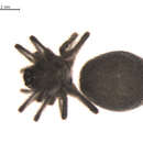 Image of Bathyphantes gracilis (Blackwall 1841)