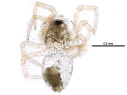 Image of Spirembolus abnormis Millidge 1980