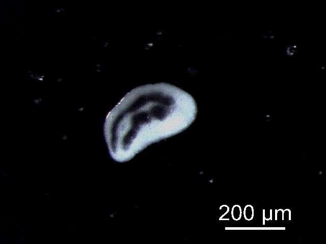 Image de Diplostomum baeri Dubois 1937