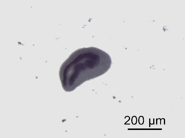 Imagem de Diplostomum baeri Dubois 1937