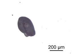 Image of <i>Diplostomum lineage</i>