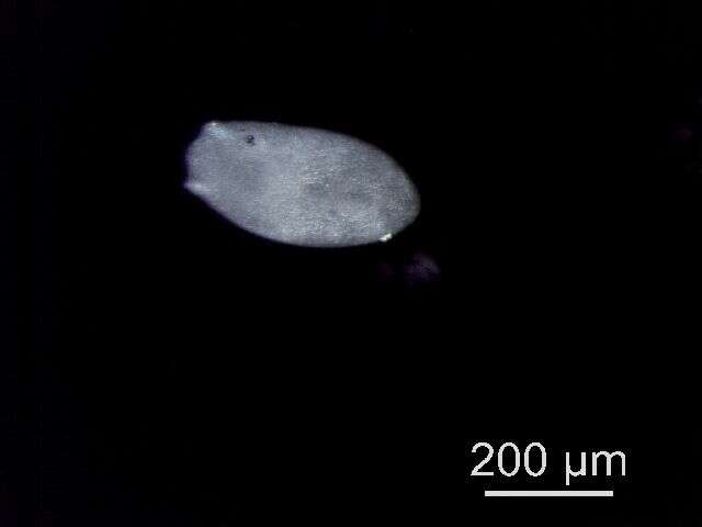 Diplostomum resmi