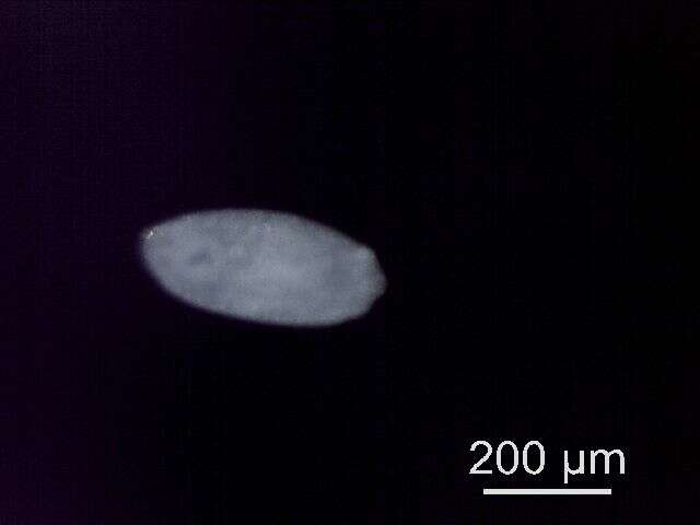 Diplostomum resmi