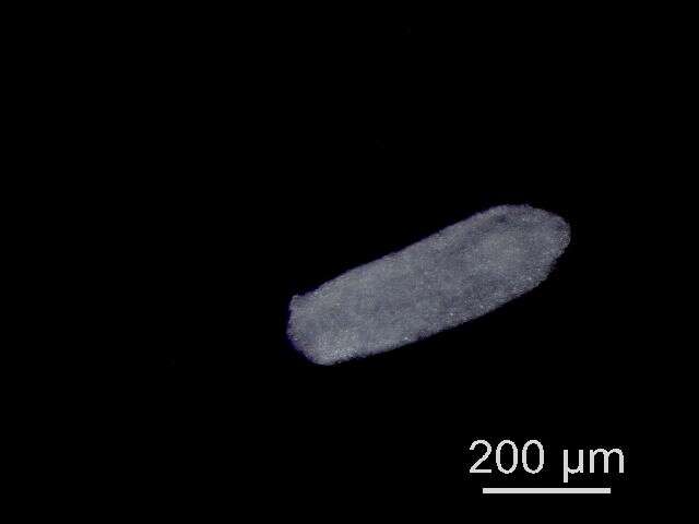 Image of Diplostomum