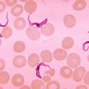 Image of Trypanosoma brucei
