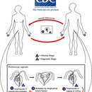 Слика од Trichomonas vaginalis