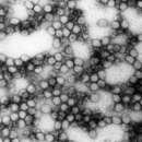 Image of Yellow fever virus