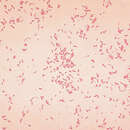 Image of Flesh-eating bacteria