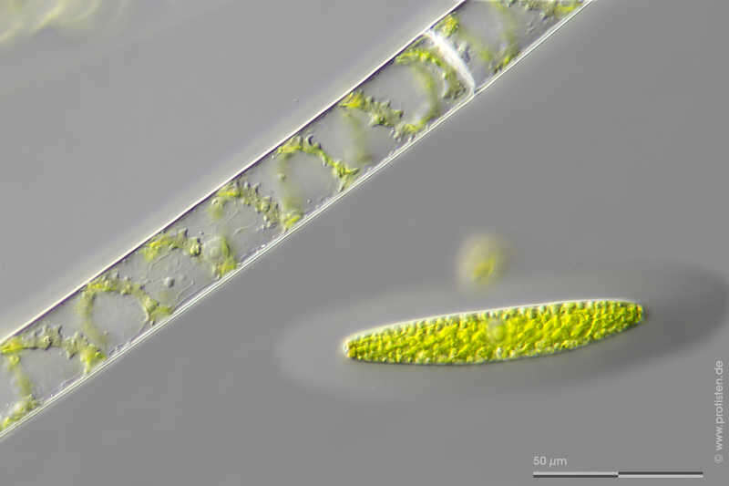 Spirogyra Link 1820 resmi