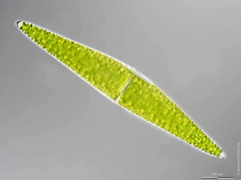 Image of Closterium lunula