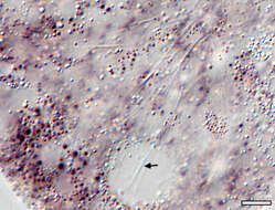 Image of Zonomyxa violacea Nüsslin 1882