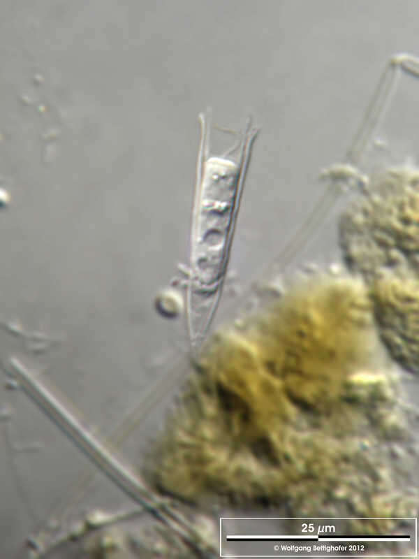 Image of Salpingoeca vaginicola Stein