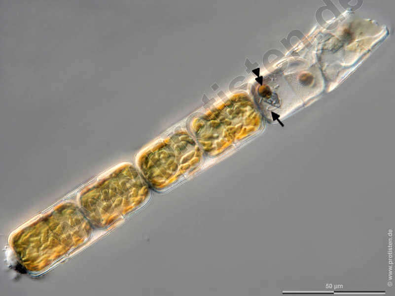 Image of Melosira moniliformis