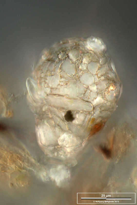 Image of Difflugiidae