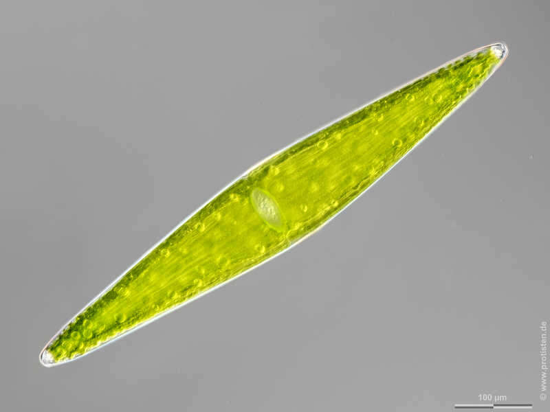 Image of Closterium lunula