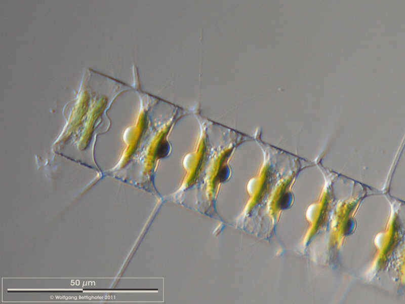 Image of Chaetoceros didymus