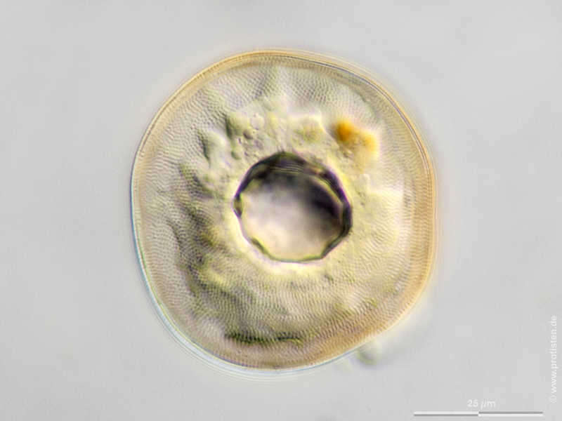 Image of Arcellidae