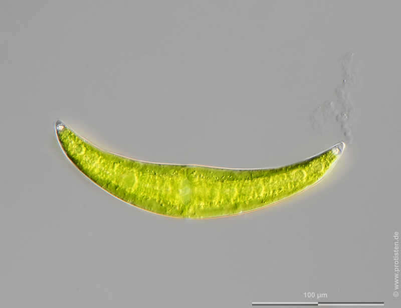 Image of Closterium moniliferum