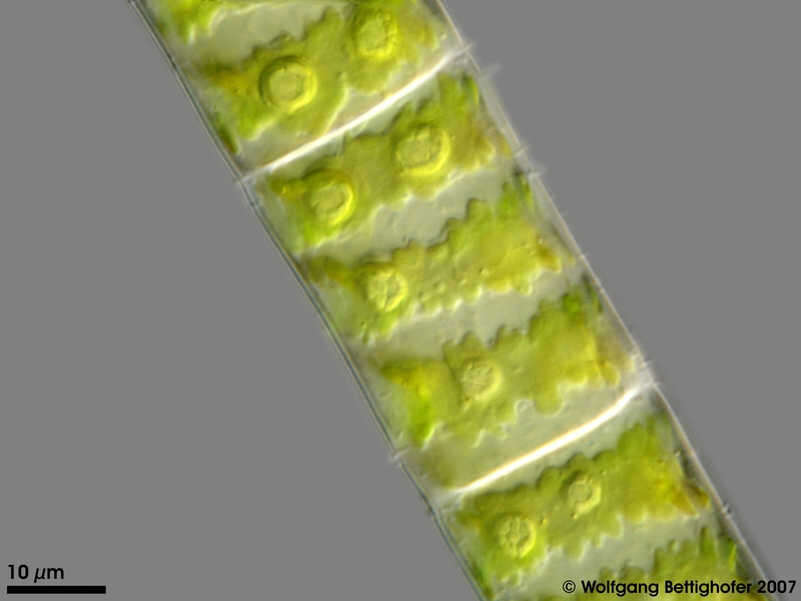 Image of Spirogyra Link 1820