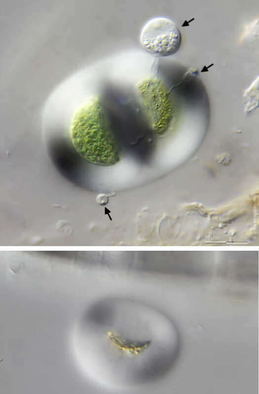 Image of Chroococcus turgidus with chytrid parasite