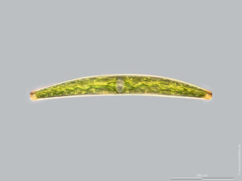 Image of Closterium striolatum Ehrenberg ex Ralfs 1848