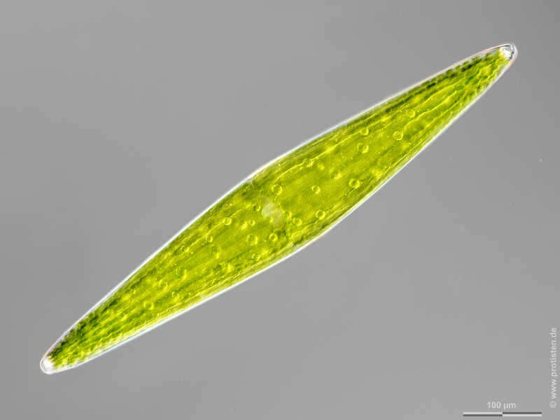 Image of Closterium lunula